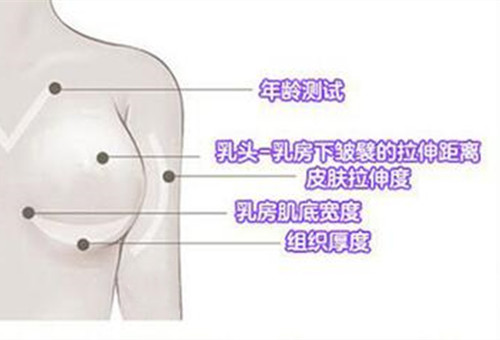 瑞丽假体隆胸方案设计理念