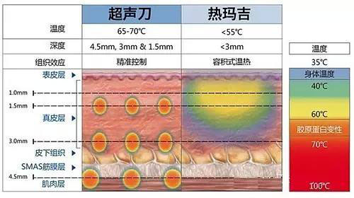 面部熱瑪吉的原理