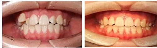 贵阳德韩口腔牙齿矫正