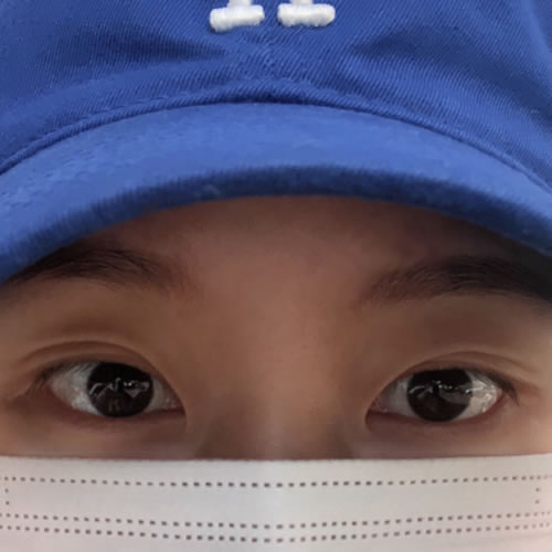 韩国Yellow整形外科眼修复术前照