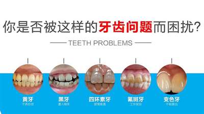 牙齿一般会出现哪些问题