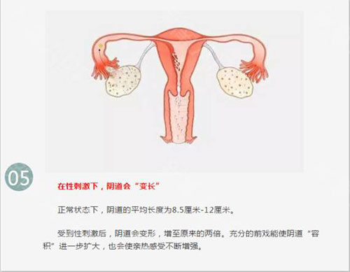 阴道紧缩示意图