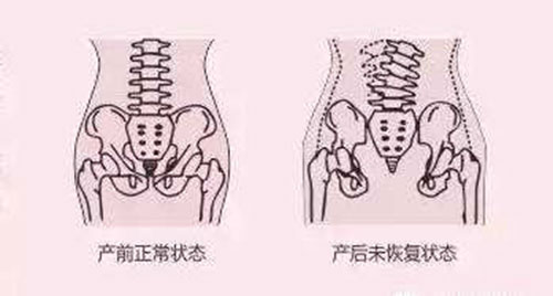 产前阴道和产后的阴道情况示意图