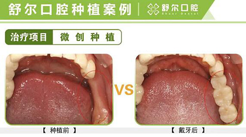 玉溪口腔医院哪里的好?三家上榜都是当地口碑好的牙科医院!