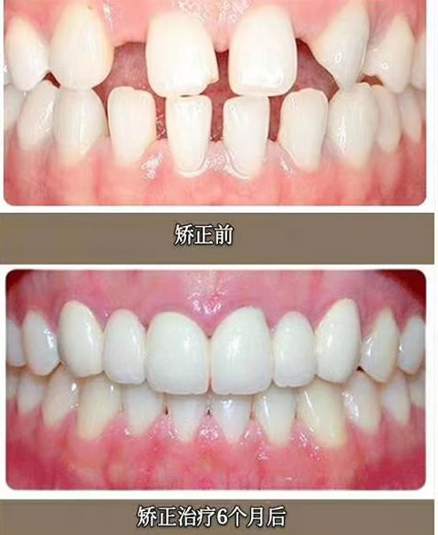 武汉牙达人口腔医院牙齿矫正图片