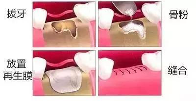 种牙骨粉过程