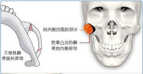 美恩保留高處的顴骨