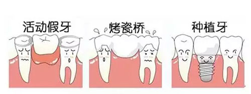 活动假牙和种植牙的区别示意图
