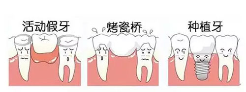 牙齿掉了咋办选择镶牙还是种植牙?植牙与镶牙的区别在哪里