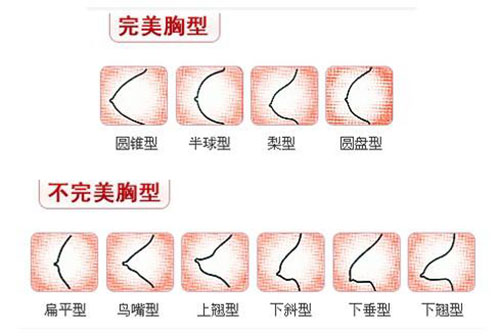 假体隆胸曼陀有几种型号?用美国曼陀假体丰胸一般多少钱?