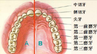 看图说穿颧穿翼种植牙!内含穿颧种植牙手术步骤!