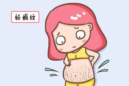 怀孕期的女性容易长妊娠纹