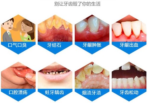 西安海涛口腔价格表公布,海涛口腔牙齿矫正种植牙价格都有