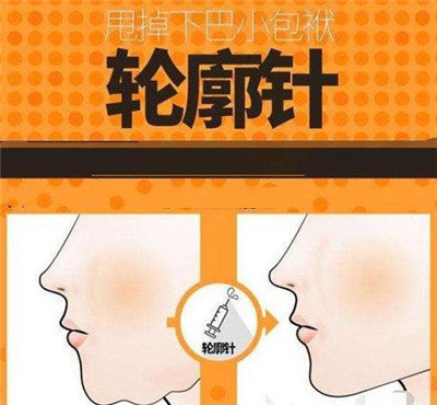 轮廓针和瘦脸针有什么区别?点击这里全部告诉你！