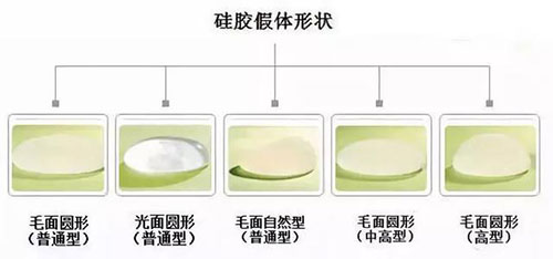 硅胶假体各种型号示意图