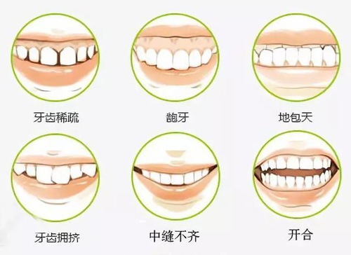 牙齒矯正改善癥狀