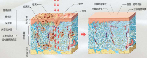 脸部松弛可以做什么微整形手术？面部提升效果能维持多久