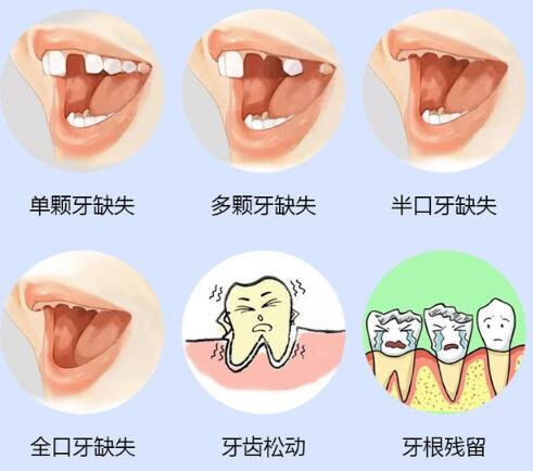 西安中诺口腔种植牙价格多少？西安中诺口腔收费高不高？