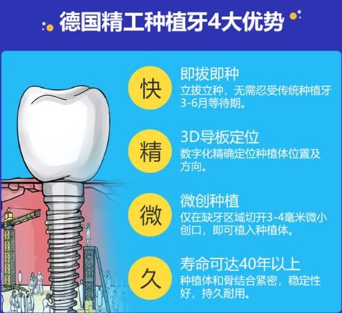 西安中诺口腔种植牙价格多少？西安中诺口腔收费高不高？