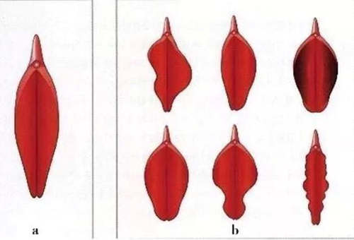 正常的小阴唇和非正常小阴唇对比