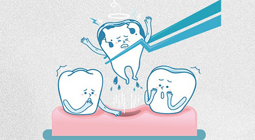 拔牙示意图