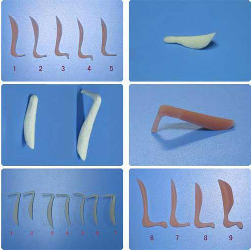硅膠假體隆鼻的示意圖