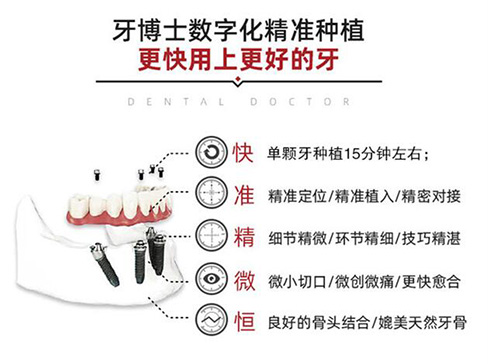 唐山种植牙哪家医院好，做种植3980元一颗还带冠划算吗？