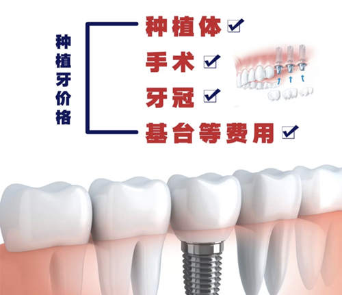 种植牙手术流分手费项目