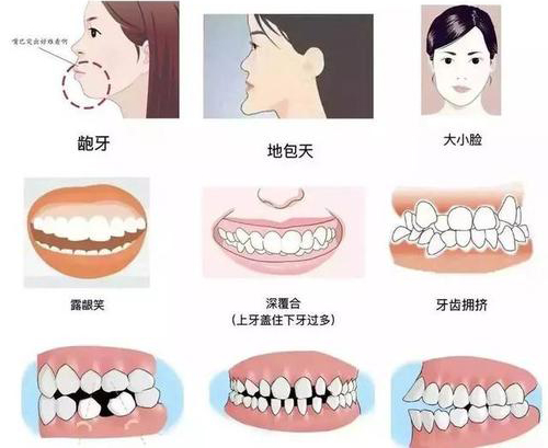 牙齿畸形问题