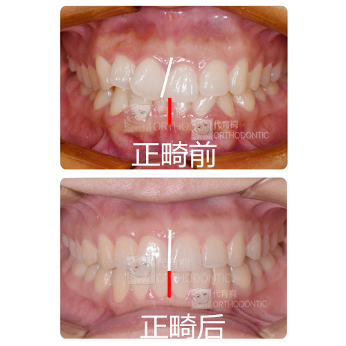 成都马泷齿科代育桐正畸好不好