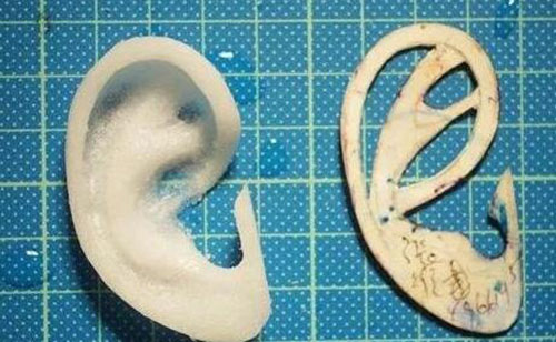 小耳矫正常用耳假体模型