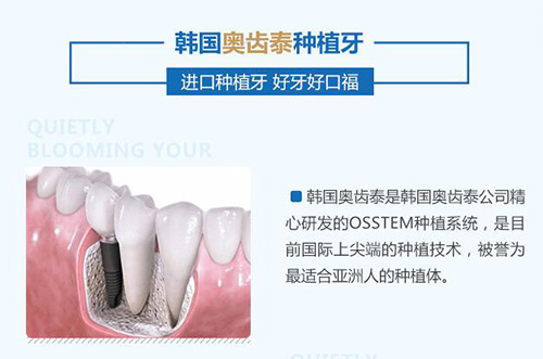 东莞种牙好的医院推荐几家 价格表揭秘东莞种牙多少钱一颗 非常爱美