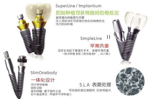 韩国奥齿泰种植牙质量怎么样？全面分析奥齿泰种植牙优劣