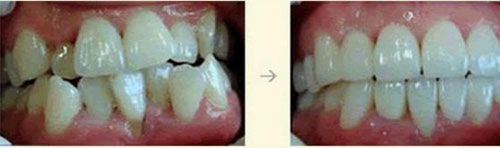 大连佳美口腔牙齿矫正