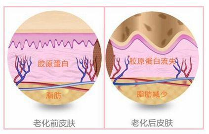 皮肤衰老对比