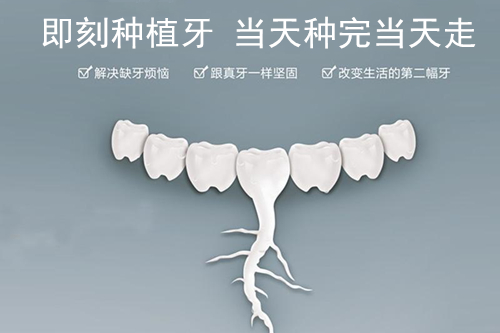 上海雅悅口腔即刻種植技術(shù)