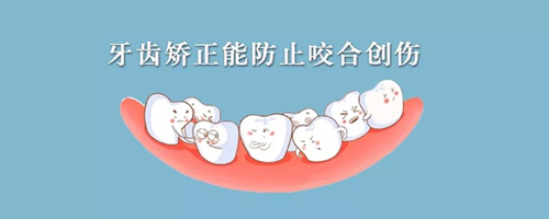牙齿矫正能防止咬合创伤