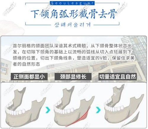 为啥下颌骨十个做了九个后悔?那是因为你医院医生都没选对!