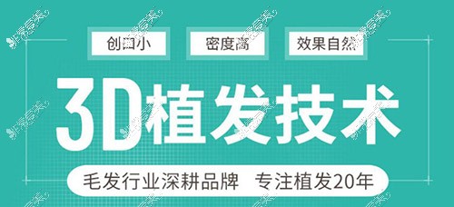 上海种植头发哪个医院好,本地人常去植发三大机构你知道吗?