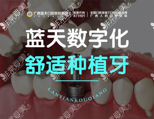 玉林蓝天口腔价目表公布，玉林蓝天口腔医院价格高吗？