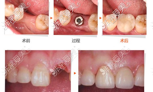 南平牙科价格更新，2021年新的口腔价目表记得收藏！