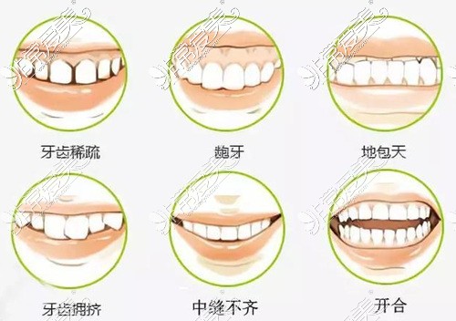 宿迁哪里整牙比较好？揭秘当地正畸好的医院及价格表！