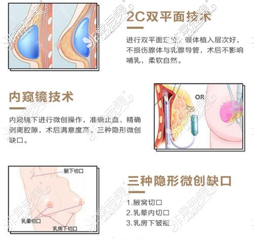 盘点烟台隆胸手术哪家好?术式、价格、效果都要看!