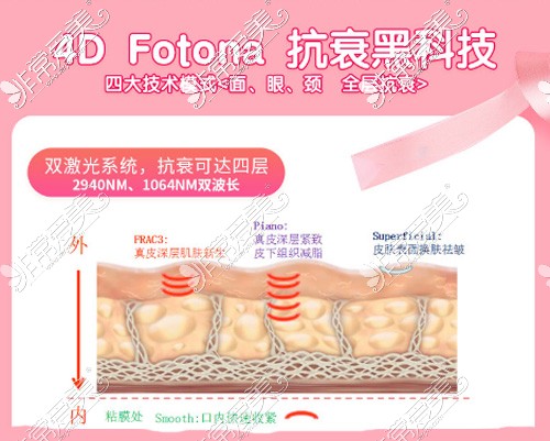 欧洲之星4d抗衰多久做一次？欧洲之星fotona4d抗衰多少钱？