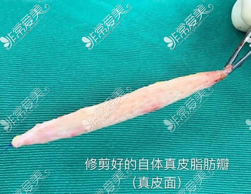 北京云全斯嘉丽医疗美容特点曝光,医生特点手术价格全给你