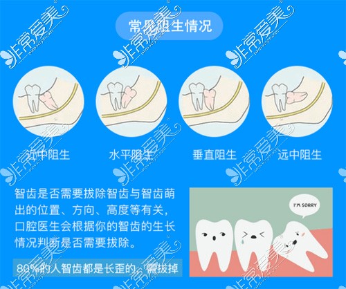 拔智齿收费价目表拔牙费用公布,医院拔智齿牙多少钱一颗？