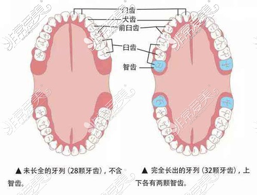 智齒牙位示意圖