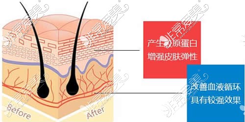 北京童仁整形医院面部提升特点分析