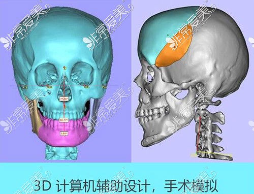 上海时光磨骨优势