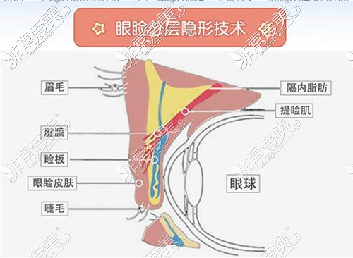 翘睫美瞳术优势